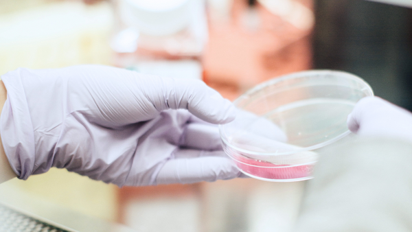 A hand in a purple latex glove holds a petri dish containing tissue culture medium. Research equipment is blurred in the background.